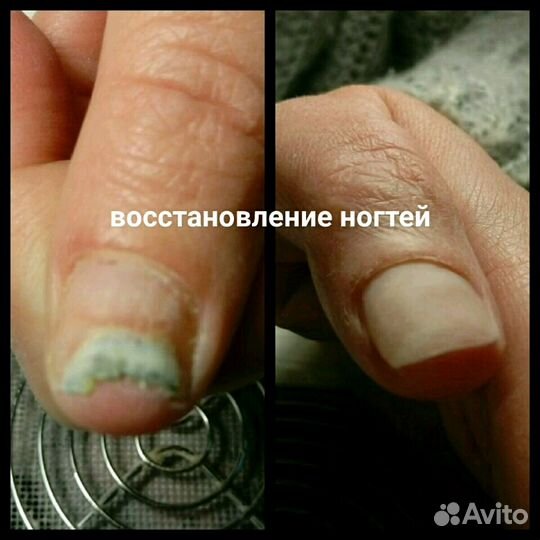 Подолог. медицинский педикюр. Г. Королёв