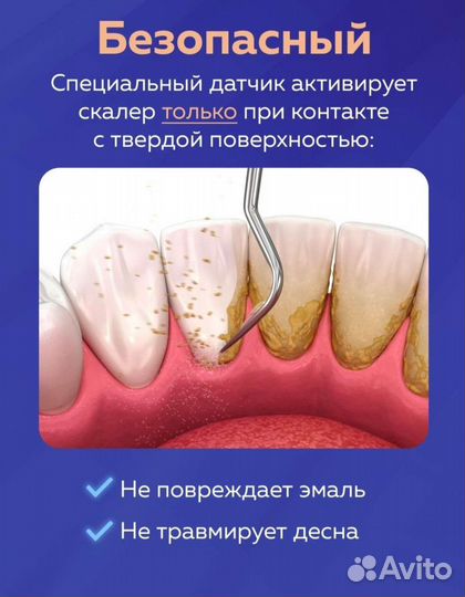 Ультразвуковой скалер для зубов новый