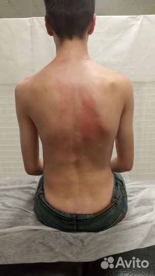 Костоправ,здоровый позвоночник