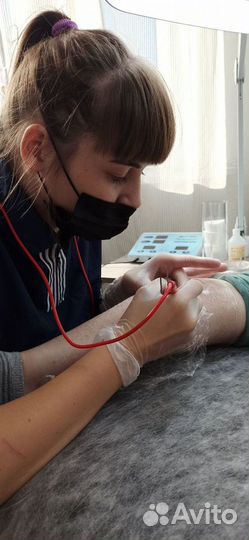 Электроэпиляция