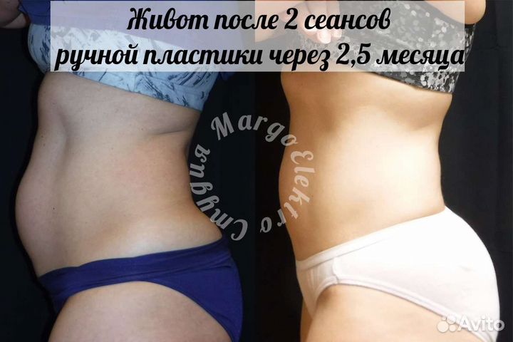 Ручная пластика тела, коррекция фигуры