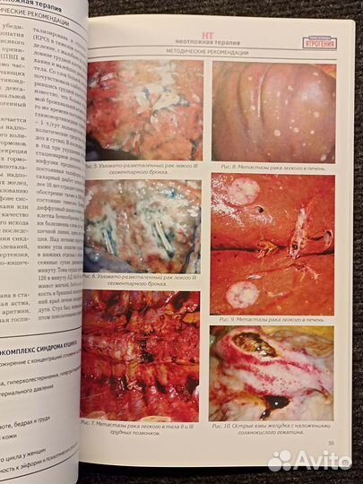 Неотложная терапия. №3-4 2006 - Ятрогения
