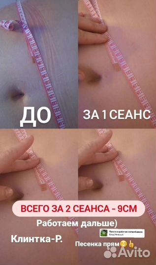 Антицеллюлитный массаж
