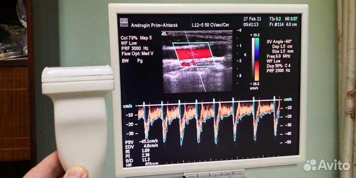 Сдаю в аренду узи аппарат, сканер ультразвуковой д
