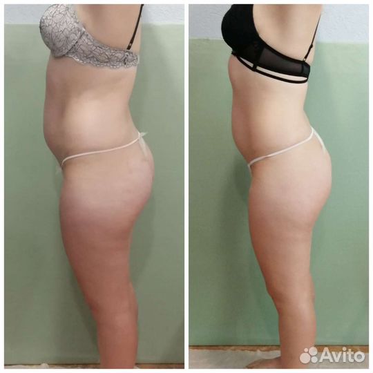 Массаж для женщин