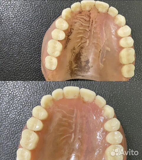 Ремонт, чистка зубных протезов