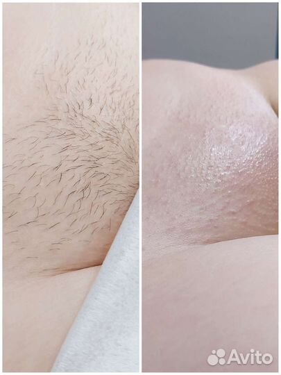 Шугаринг. Воск. Владимира Невского 17