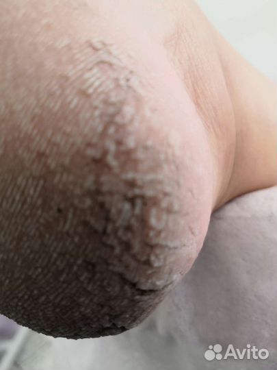 Педикюр для мужчин