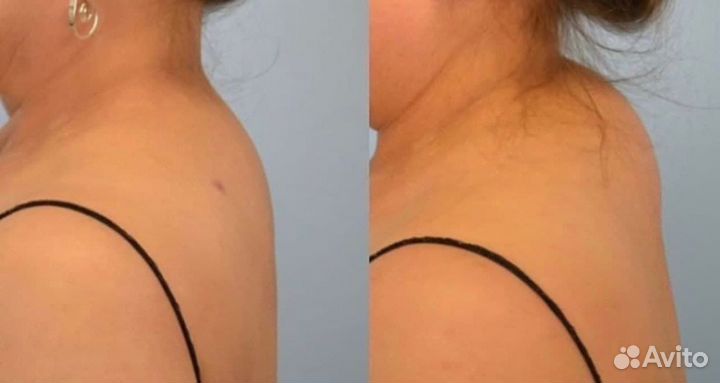 Массаж. Мануальный, классический. Опыт 20 лет