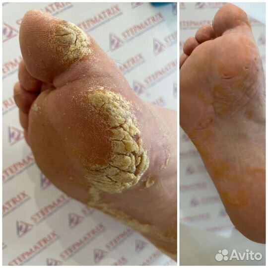 Подолог(химки,куркино,новогорск),подолог(выезд)