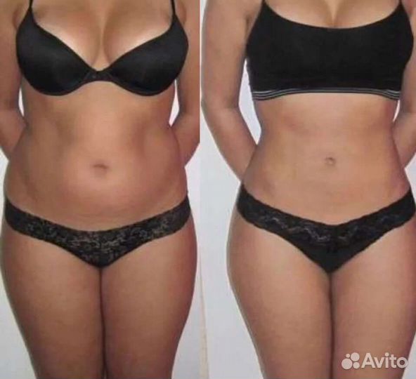 Антицеллюлитный массаж тела