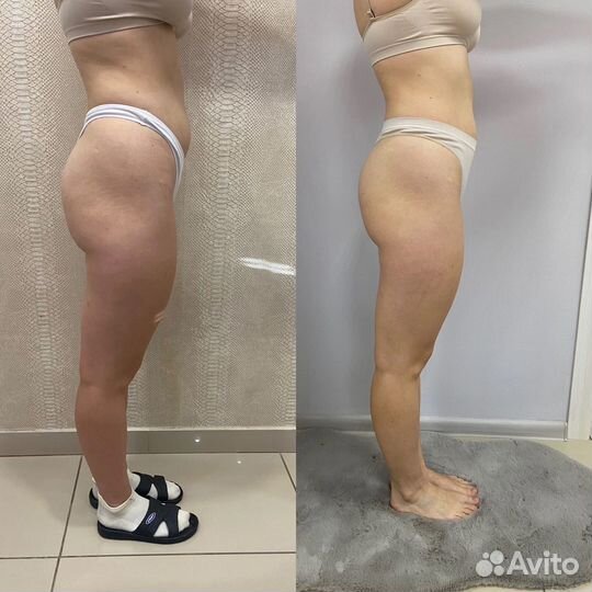 Марафон стройности