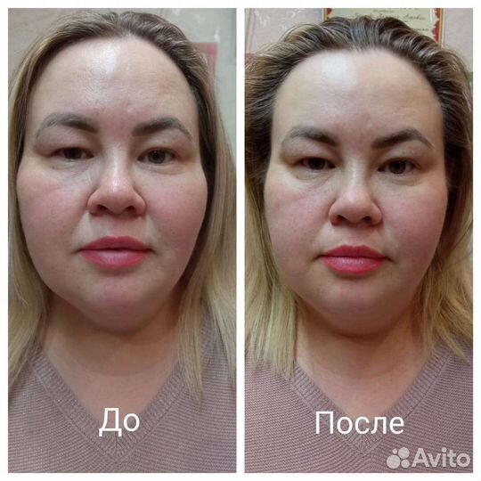 Массаж лица