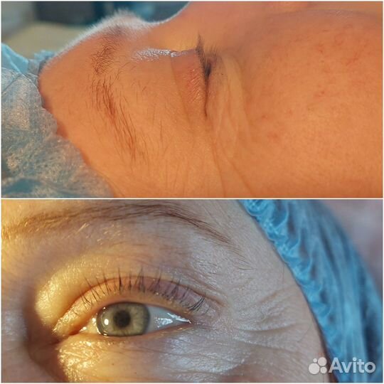 Ламинирование и ботокс ресниц