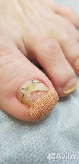 Услуги подолога