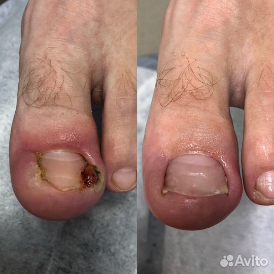 Кабинет педикюра, подолог Лобня