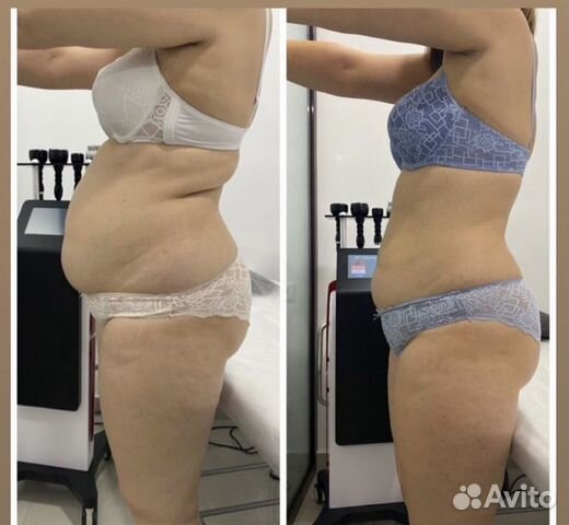 Услуги косметолога