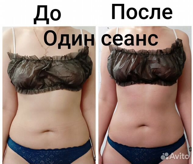Массаж апельсинами / карамельная липосакция