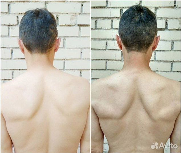 Остеопатический массаж. Массаж стопами