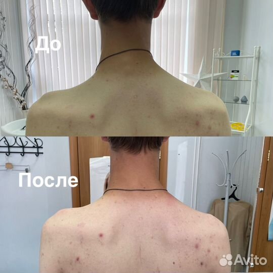 Массаж, кинезиолог-массажист