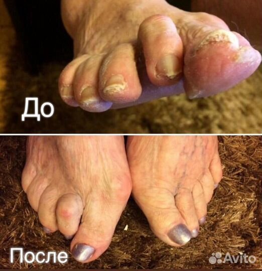 Подолог с выездом на дом