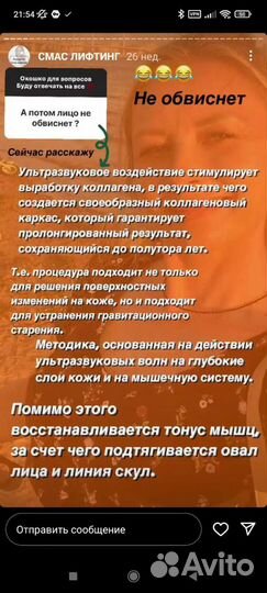 SMAS лифтинг лица