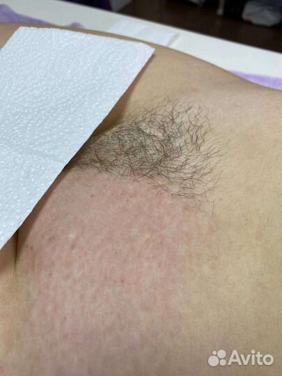 SPA- Шугаринг