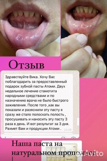 Зубная паста атоми