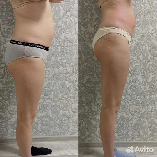 Антицеллюлитный массаж и коррекция фигуры