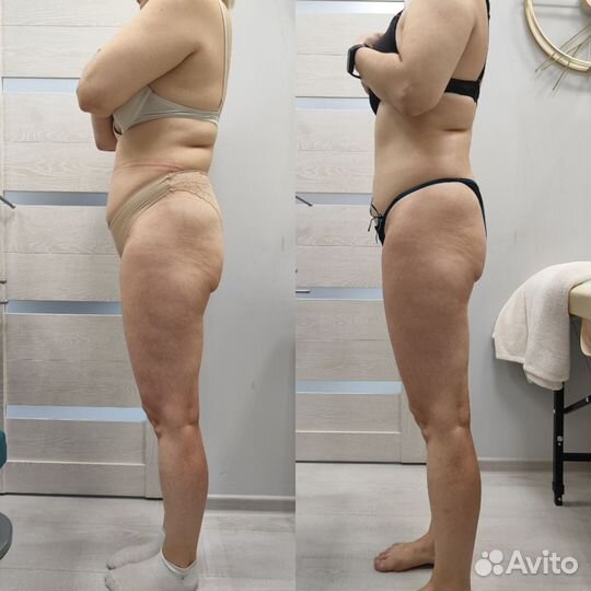 Антицеллюлитный массаж ищу модель