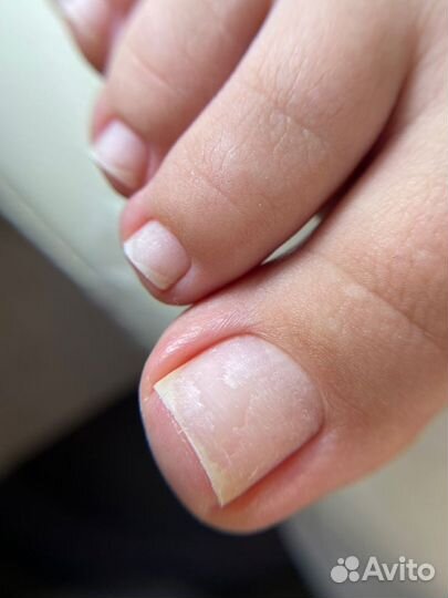 Педикюр гигиена и эстетика, без подологии