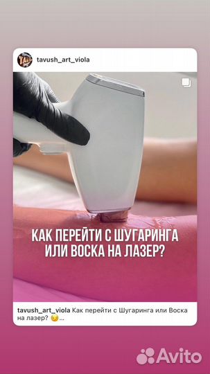 Лазерная эпиляция