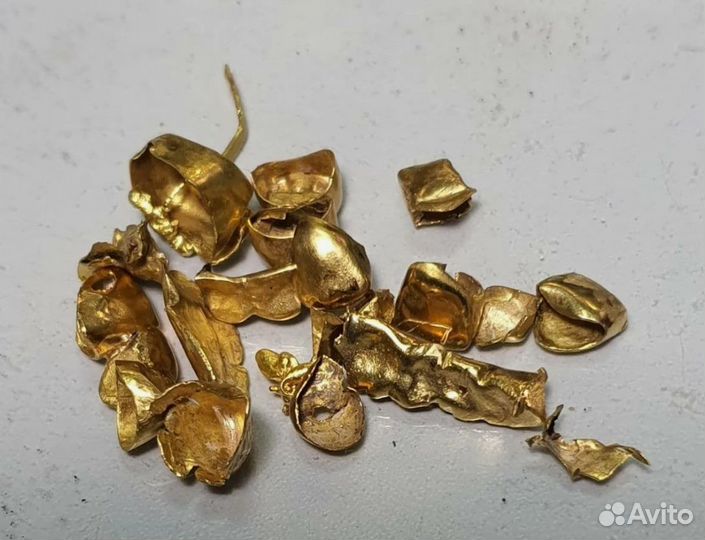 Скупка Золота, Золотых коронок