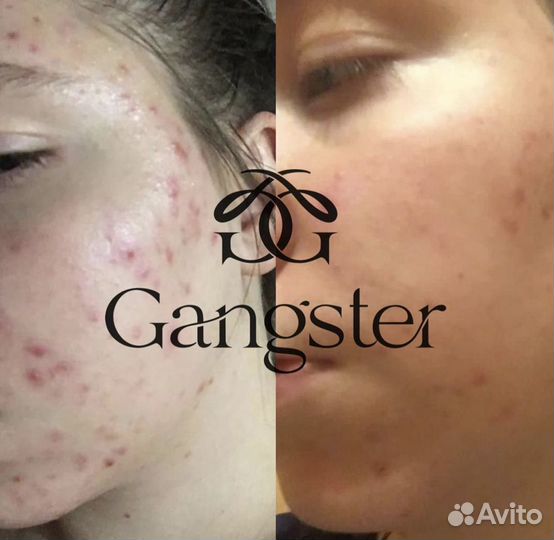 Болтушка для проблемной кожи