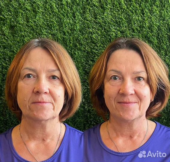 Массаж лица