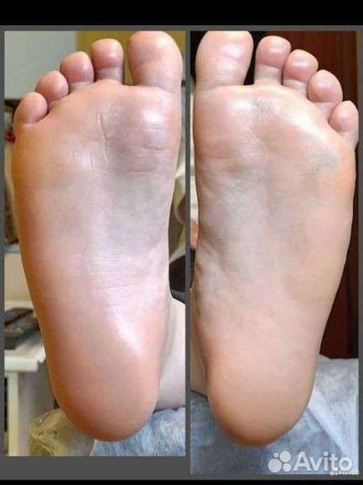 Смарт педикюр