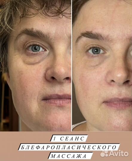 Миофасциальный массаж лица и головы