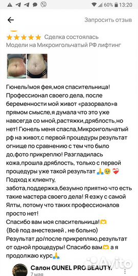 Микроигольчатый Рф-лифтинг