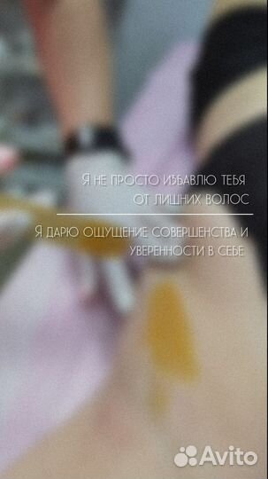 Депиляция