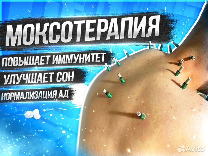 Массаж Реабилитация Иглоукалывание Инсульт