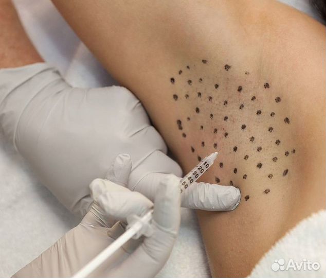 Ботокс для лица