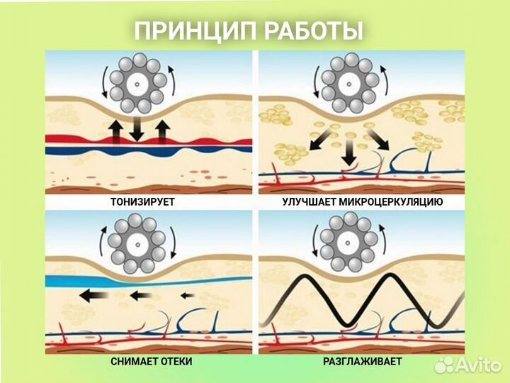 Сферотерапия (аналог эндосферы)