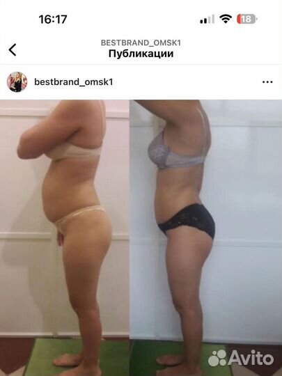 Ищем моделей/похудение/коррекция фигуры