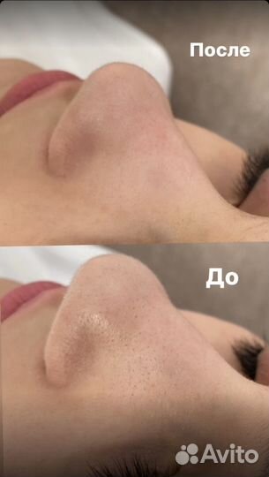 Косметолог эстетист