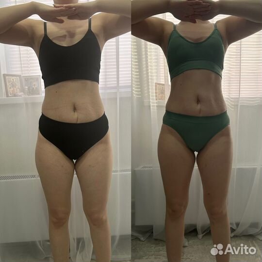 Антицеллюлитный массаж