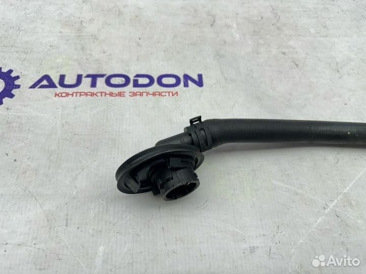 Патрубок системы охлаждения Mercedes C-Class W204