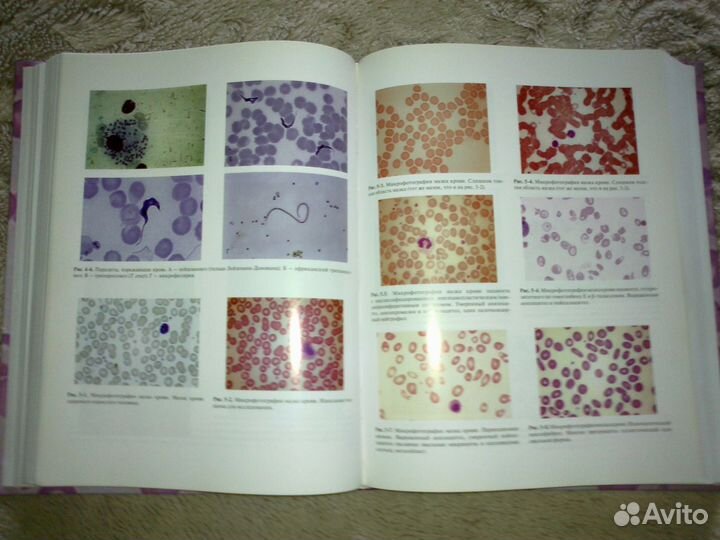 Практическая и лабораторная гематология Льюис С.М