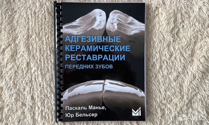 Адгезивные керамические реставрации