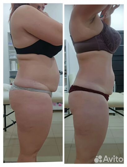 Массаж. Аппаратная коррекция фигуры. Снижение веса