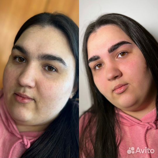 Бровист
